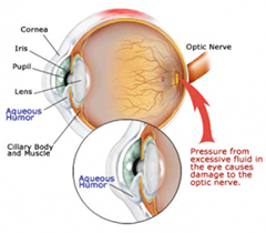 bn_diabetic_retinopathy